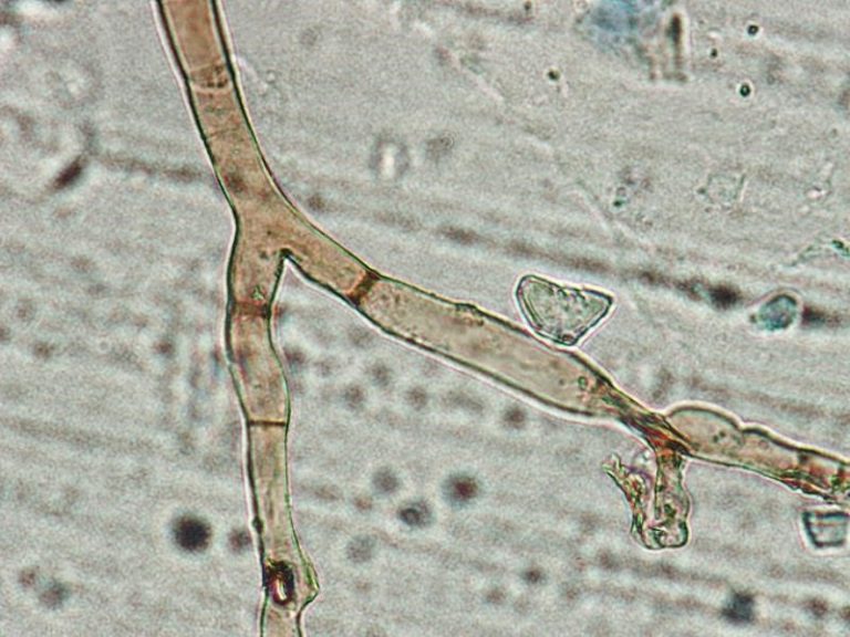 Fungos e o Reino Fungi: características, exemplos e importância