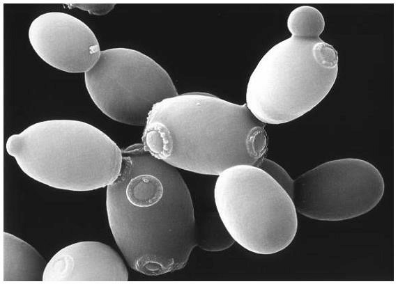 Fungos e o Reino Fungi: características, exemplos e importância
