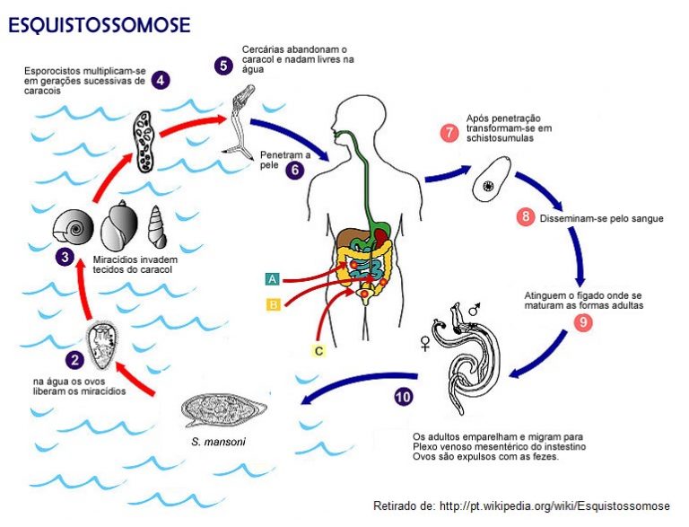 Esquistossomose: o que é, sintomas, diagnóstico e tratamento